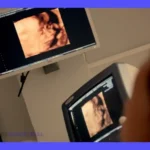 Handheld scanners: Tipos, qué es, y cómo elegir el correcto