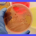 Microbiología alimentaria: Cómo garantizar la calidad de tus alimentos